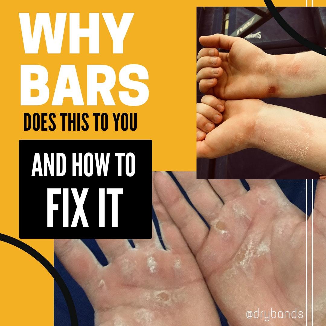 Why do BARS cause RIPS? And how to FIX it!